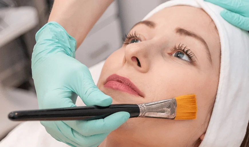 Na zdjęciu widoczna jest kobieta poddawana zabiegowi kosmetycznemu z użyciem kwasów AHA. Kosmetyczka w rękawiczkach ochronnych aplikuje preparat pędzelkiem na twarz klientki, która leży zrelaksowana z opaską na głowie. Zabieg ten ma na celu złuszczenie martwego naskórka, poprawę kolorytu skóry oraz redukcję niedoskonałości, co daje efekt odświeżonej i promiennej cery.