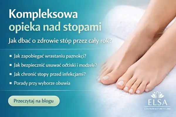 Zdrowe i zadbane stopy leżące na białym ręczniku, z nawilżoną skórą i zadbanymi paznokciami, obok nagłówka „Kompleksowa opieka nad stopami” z poradami dotyczącymi zapobiegania wrastaniu paznokci, usuwania modzeli i ochrony stóp, grafika promująca poradnik na blogu Centrum Kosmetyczne ELSA.