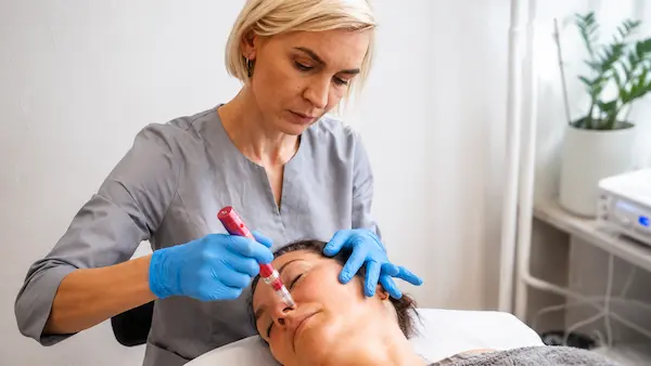 Mezoterapia mikroigłowa w Centrum Kosmetycznym ELSA w Rzeszowie – zabieg mikronakłuwania skóry
