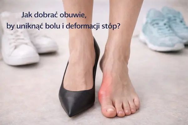 Jak dobrać obuwie, by uniknąć bólu i deformacji stóp?