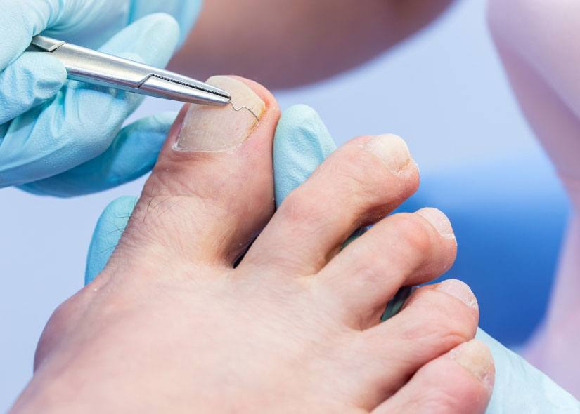 Czym zajmuje się podolog w salonie kosmetycznym?