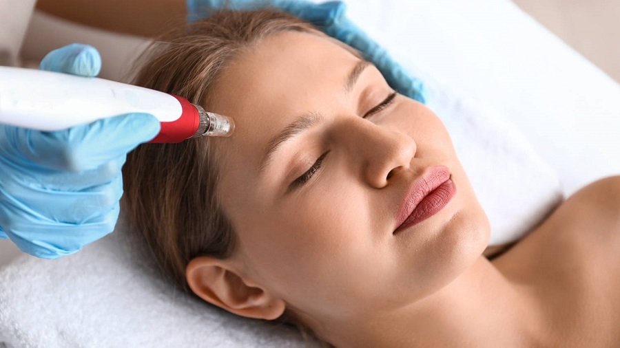 Jak pielęgnować skórę po zabiegu mezoterapii mikroigłowej – krok po kroku