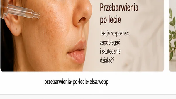 Przebarwienia skóry po lecie – pielęgnacja i zabiegi kosmetologiczne